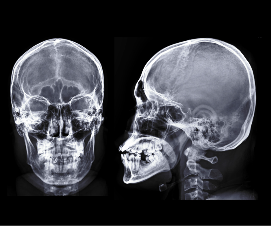 What species are you? Understanding the Human Species: Evolution & Optimal Diet for Humans