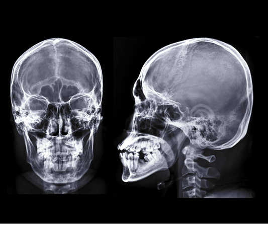 What species are you? Understanding the Human Species: Evolution & Optimal Diet for Humans